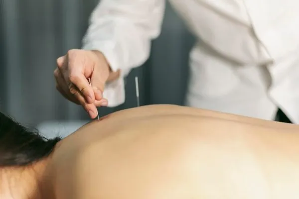 Acupuncture & Acupressure